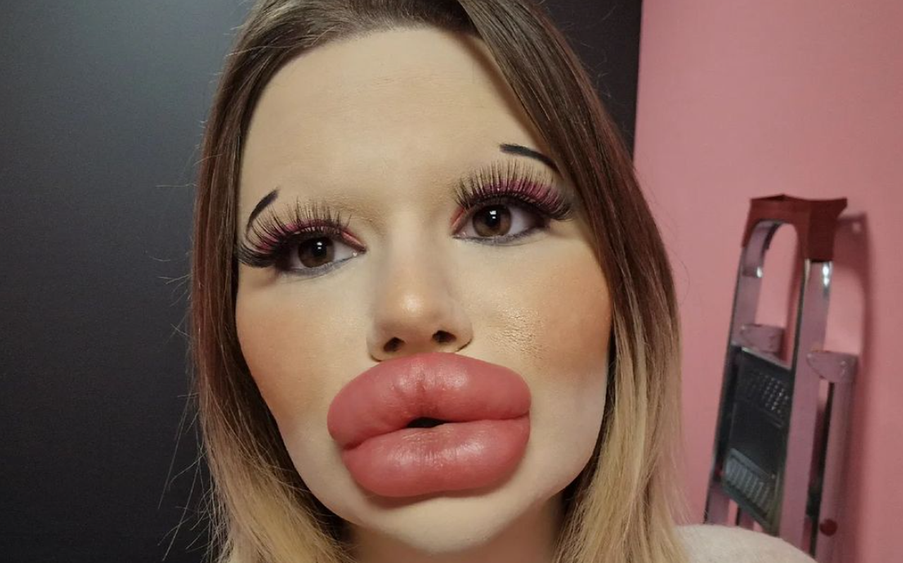 Deze Influencer Heeft De Grootste Lippen Ter Wereld Nu Is Ze Toe Aan De Volgende